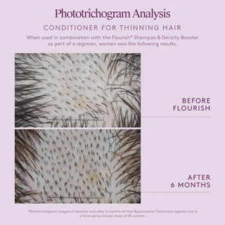 Flourish® Thickening Conditioner for Thinning Hair